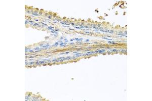 Immunohistochemistry of paraffin-embedded human prostate using PIP antibody (ABIN6131693, ABIN6145670, ABIN6145672 and ABIN6222022) at dilution of 1:100 (40x lens). (PIP anticorps  (AA 29-146))