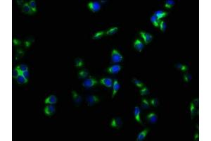 Immunofluorescence staining of Hela cells with ABIN7175125 at 1:133, counter-stained with DAPI. (PLAUR anticorps  (AA 23-305))