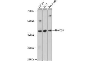 Western blot analysis of extracts of various cell lines, using FBXO28 antibody (ABIN7267088) at 1:1000 dilution. (FBXO28 anticorps  (AA 91-312))