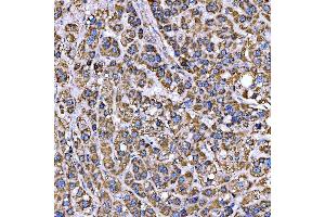 IHC analysis of RAB3GAP1 using anti-RAB3GAP1 antibody (ABIN7599702). (RAB3GAP1 anticorps  (AA 109-810))