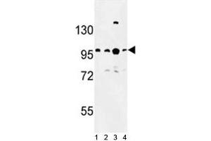 Western blot analysis of BCL11A antibody and 1) Jurkat, 2) Ramos, 3) 293 and 4)NCI-H460 lysate. (BCL11A anticorps  (AA 806-835))