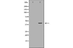 Western blot analysis of extracts of K562, using ABO antibody. (ABO anticorps  (N-Term))