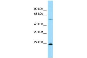 Host: Rabbit Target Name: Rpl17 Sample Type: Rat Pancreas lysates Antibody Dilution: 1. (RPL17 anticorps  (C-Term))