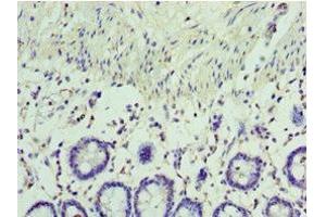Immunohistochemistry of paraffin-embedded human colon tissue using ABIN7167058 at dilution of 1:100 (RSAD2 anticorps  (AA 42-361))