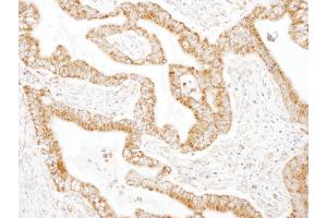 Immunohistochemistry (IHC) image for anti-Glutamic-Oxaloacetic Transaminase 2, Mitochondrial (Aspartate Aminotransferase 2) (GOT2) (AA 380-430) antibody (ABIN7454581) (GOT2 anticorps  (AA 380-430))