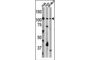 Image no. 1 for anti-Retinoblastoma 1 (RB1) (pSer612) antibody (ABIN358212) (Retinoblastoma 1 anticorps  (pSer612))