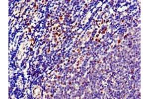 Immunohistochemistry of paraffin-embedded human lymph node tissue using ABIN7150733 at dilution of 1:100 (Mps1 anticorps  (AA 370-492))