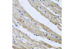 Immunohistochemistry of paraffin-embedded rat heart using ST8SIA2 antibody at dilution of 1:100 (x40 lens). (ST8SIA2 anticorps)