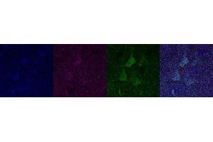 Immunohistochemistry (IHC) image for anti-Ubiquitin Carboxyl-terminal Esterase L1 (Ubiquitin Thiolesterase) (UCHL1) antibody (ABIN7456063)
