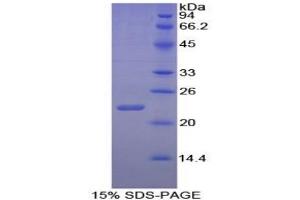 SDS-PAGE of Protein Standard from the Kit (Highly purified E.