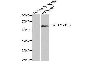 Western blot analysis of extracts from MCF7 cells using Phospho-ESR1-S167 antibody. (Estrogen Receptor alpha anticorps  (pSer167))