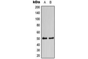 Western blot analysis of CaMK2 alpha/delta expression in HEK293A (A), NIH3T3 (B) whole cell lysates. (CaMK2 alpha/delta anticorps  (Center))