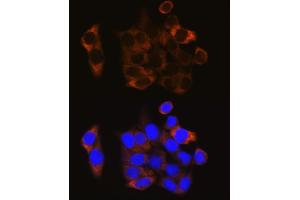 Immunofluorescence analysis of HeLa cells using Calpain 1 antibody (ABIN3021622, ABIN3021623, ABIN3021624, ABIN1512666 and ABIN6215416) at dilution of 1:100.
