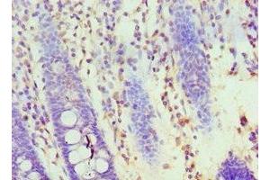 Immunohistochemistry of paraffin-embedded human colon tissue using ABIN7155707 at dilution of 1:100 (HOXA1 anticorps  (AA 75-205))