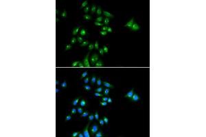 Immunofluorescence analysis of U2OS cell using PHC3 antibody. (PHC3 anticorps)