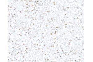 Immunohistochemistry (IHC) image for anti-SWI/SNF Related, Matrix Associated, Actin Dependent Regulator of Chromatin, Subfamily E, Member 1 (SMARCE1) (C-Term) antibody (ABIN7795731)