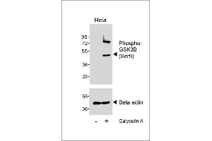 Western blot analysis of lysates from Hela cell line, untreated or treated with Calyculin A, 100nM, 30 min, using Phospho--GSK3B (Ser9) Antibody (upper) or Beta-actin (lower). (GSK3 beta anticorps  (pSer9))
