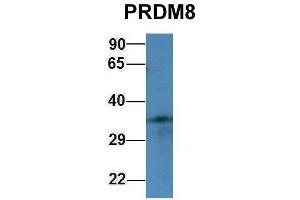 Host:  Rabbit  Target Name:  PRDM8  Sample Type:  293T  Antibody Dilution:  1. (PRDM8 anticorps  (N-Term))