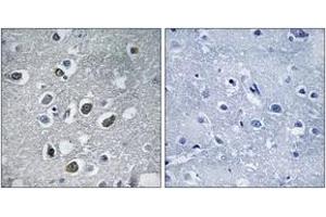 Immunohistochemistry analysis of paraffin-embedded human brain tissue, using MARCH4 Antibody. (MARCH4 anticorps  (AA 301-350))
