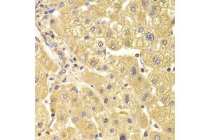 Immunohistochemistry of paraffin-embedded human liver injury using TRAF3IP2 Antibody (ABIN5974104) at dilution of 1/100 (40x lens).