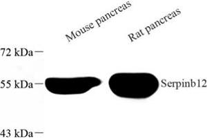 Western blot analysis of Serpinb12 (ABIN7075568) at dilution of 1: 500 (SERPINB12 anticorps)