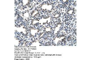 Human Lung (KCTD6 anticorps  (N-Term))