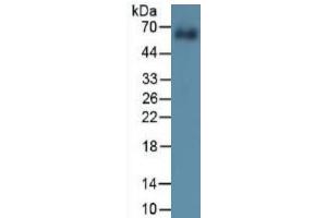Mouse Capture antibody from the kit in WB with Positive Control: Sample Human cartilage tissue. (COL10 Kit ELISA)