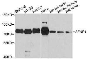 Western blot analysis of extracts of various cell lines, using SENP1 antibody. (SENP1 anticorps  (AA 220-420))