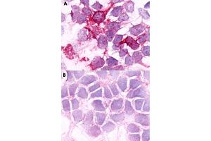 Immunocytochemical staining of HEK293 human embryonic kidney cells transfected (A) and untransfected (B) with BDKRB2. (BDKRB2 anticorps  (C-Term))