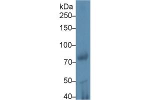 Western blot analysis of Rat Testis lysate, using Mouse iPLA2 Antibody (1 µg/ml) and HRP-conjugated Goat Anti-Rabbit antibody ( (PNPLA2 anticorps  (AA 481-702))