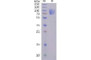SARS-CoV-2 (2019-nCoV) S1 protein NTD, mFc Tag on SDS-PAGE under reducing condition.