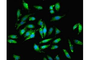 Immunofluorescent analysis of Hela cells using ABIN7151346 at dilution of 1:100 and Alexa Fluor 488-congugated AffiniPure Goat Anti-Rabbit IgG(H+L)