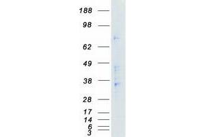 Validation with Western Blot