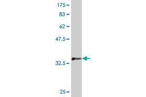 Western Blot detection against Immunogen (37. (SKP1 anticorps  (AA 53-160))