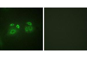 Peptide - +Immunofluorescence analysis of A549 cells, using Arrestin 1 (Ab-412) antibody. (SAG anticorps  (Ser412))