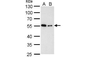 WB Image Alpha Tubulin antibody detects alpha Tubulin protein by western blot analysis. (TUBA1B anticorps)