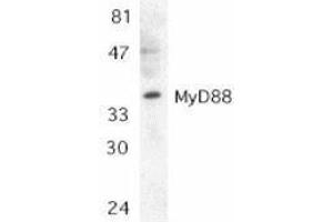 Western Blotting (WB) image for anti-Myeloid Differentiation Primary Response Gene (88) (MYD88) (AA 279-296) antibody (ABIN2475775) (MYD88 anticorps  (AA 279-296))