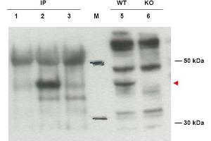 Image no. 1 for anti-Diaphanous Homolog 2 (DIAPH2) (AA 1085-1101), (Isoform 2) antibody (ABIN401289) (DIAPH2 anticorps  (Isoform 2))