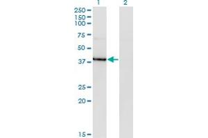 Western Blot analysis of HDAC8 expression in transfected 293T cell line by HDAC8 monoclonal antibody (M07), clone 2F4. (HDAC8 anticorps  (AA 1-100))