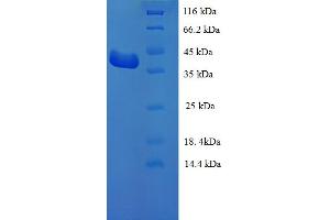 SDS-PAGE (SDS) image for Leucine Rich Repeat (In FLII) Interacting Protein 1 (LRRFIP1) (AA 1-321), (partial) protein (His tag) (ABIN5709881)