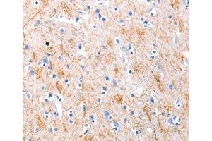Immunohistochemistry (IHC) image for anti-KiSS-1 Metastasis-Suppressor (KISS1) antibody (ABIN1680598) (KISS1 anticorps)
