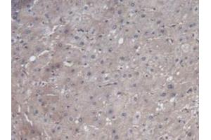 Detection of VEGF121 in Human Liver Tissue using Monoclonal Antibody to Vascular Endothelial Growth Factor 121 (VEGF121)