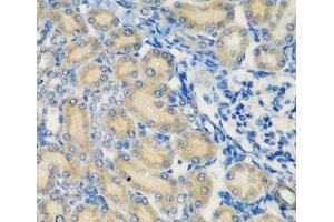 Immunohistochemistry of paraffin-embedded Rat kidney using C1S Polyclonal Antibody at dilution of 1:200 (40x lens). (C1S anticorps)