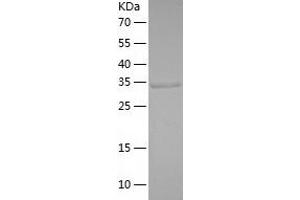 Western Blotting (WB) image for Glyoxylate Reductase/hydroxypyruvate Reductase (GRHPR) (AA 1-328) protein (His tag) (ABIN7123175) (GRHPR Protein (AA 1-328) (His tag))