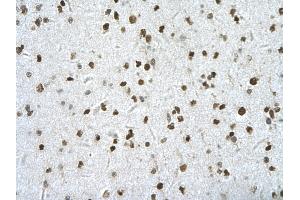 Rabbit Anti-HIPK2 Antibody       Paraffin Embedded Tissue:  Human neural cell   Cellular Data:  Epithelial cells of renal tubule  Antibody Concentration:   4. (HIPK2 anticorps  (Middle Region))