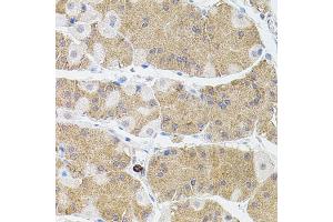 Immunohistochemistry of paraffin-embedded human stomach using MMP9 antibody (ABIN4904399) at dilution of 1:100 (40x lens). (MMP 9 anticorps)