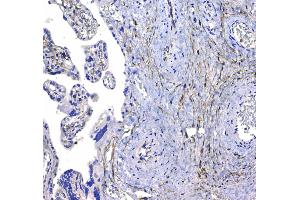 IHC analysis of CD44 using anti-CD44 antibody .