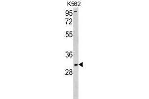 Western blot analysis of SOD3 Antibody (N-term) in K562 cell line lysates (35ug/lane). (SOD3 anticorps  (N-Term))
