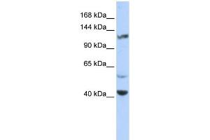 WB Suggested Anti-KCNH3 Antibody Titration:  0. (KCNH3 anticorps  (Middle Region))