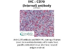 Image no. 2 for anti-CD70 Molecule (CD70) (Internal Region) antibody (ABIN1732875)